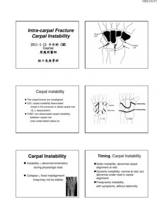 Intra-carpal Fracture Instability