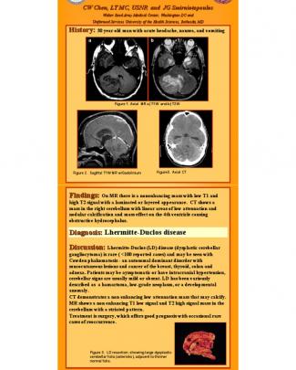 Neuroradiology - Cotd - Smirniotopoulos (rsna 2003).pdf